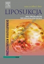 Liposukcja. Seria Dermatologia Kosmetyczna