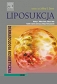 Liposukcja. Seria Dermatologia Kosmetyczna