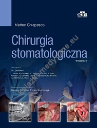 Chirurgia stomatologiczna