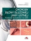 Choroby błony śluzowej jamy ustnej