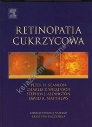 Retinopatia cukrzycowa