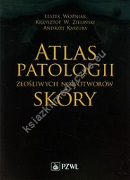 Atlas patologii złośliwych nowotworów skóry