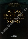 Atlas patologii złośliwych nowotworów skóry