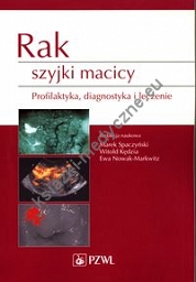 Rak szyjki macicy