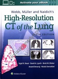 Webb, Müller and Naidich's High-Resolution CT of the Lung Sixth edition