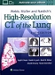 Webb, Müller and Naidich's High-Resolution CT of the Lung Sixth edition