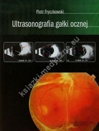 Ultrasonografia gałki ocznej