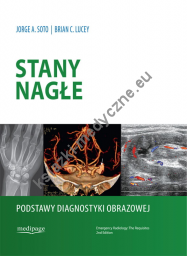 Stany nagłe. Podstawy diagnostyki obrazowej. Jorge A. Soto