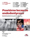 Powtórne leczenie endodontyczne