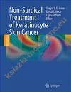 Non Surgical Treatment of Keratinocyte Skin Cancer