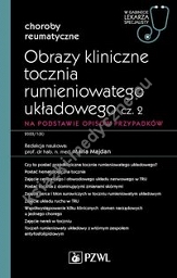 Obrazy kliniczne tocznia rumieniowatego układowego Część 2