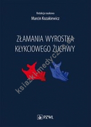 Złamania wyrostka kłykciowego żuchwy