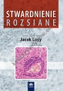 Stwardnienie rozsiane