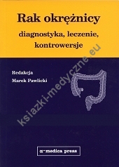 Rak okrężnicy - diagnostyka, leczenie, kontrowersje