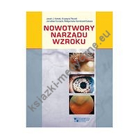 Nowotwory narządu wzroku