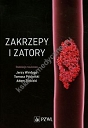 Zakrzepy i zatory