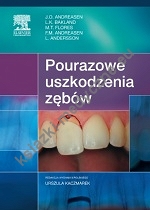 Pourazowe uszkodzenia zębów wyd.II